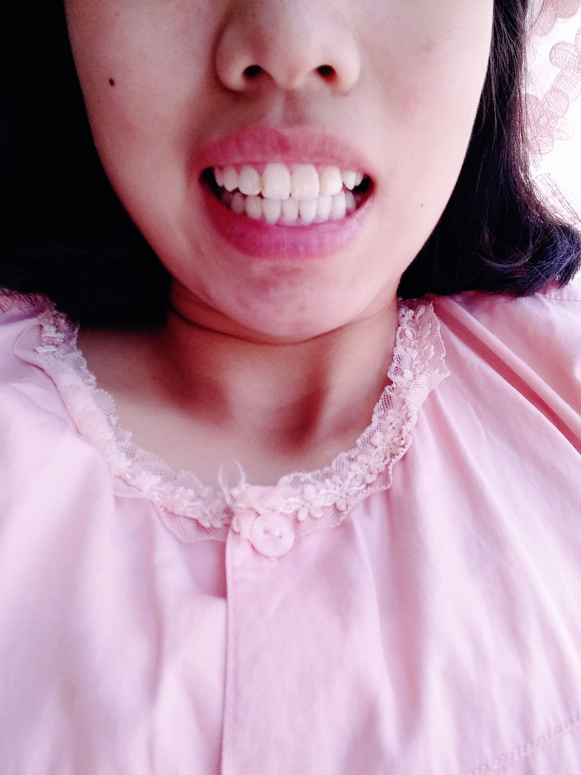 正常牙齿咬合图(正常牙齿咬合图 标准) 正常牙齿咬合图(正常牙齿咬合图 标准)