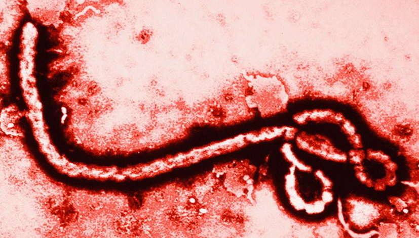 艾博拉病毒(埃博拉病毒现在可以治愈吗)