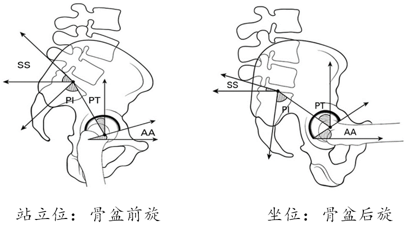 托马斯征(托马斯征+的临床意义) 托马斯征(托马斯征+的临床意义)