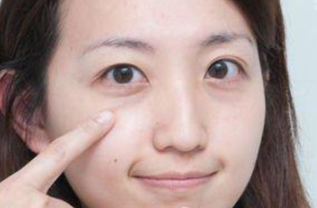 内眼睑(内眼睑在哪个部位图片)